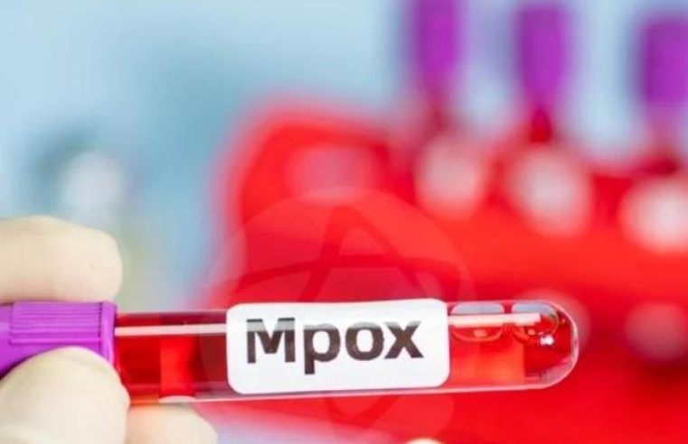 OMS: África soma quase 30 mil casos suspeitos de mpox este ano